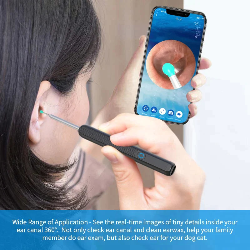 Ear Wax Cleaner Pro - dealshub
